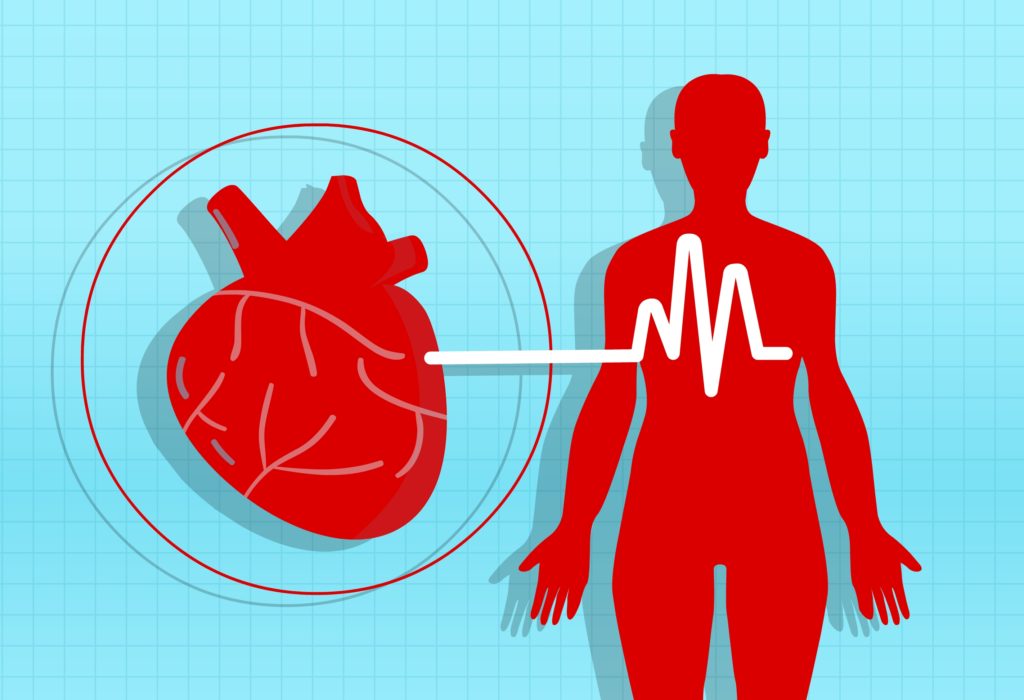 što je hipertenzija stupanj 2 srca