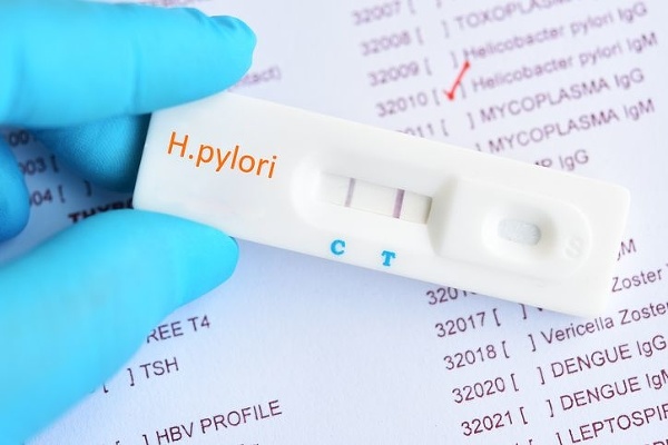 Helicobacter pylori test